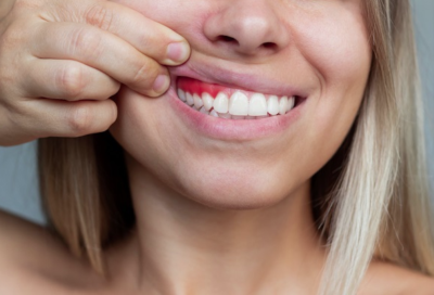 Jamun Seeds Teeth Whitening Powder